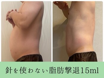 ソルニスデュオ(Solnis.-duo-)/痩身/酵素浴/毛穴/よもぎ蒸し