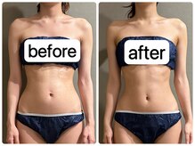 メロウ(me: llow)/よもぎ蒸し/ハイパーナイフEX