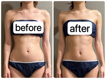 メロウ(me: llow)/よもぎ蒸し/ハイパーナイフEX