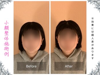 ボディ リセット アンド デザイン(Body Reset & Design)/【施術例】ビフォーアフター