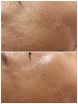 凛と慶/お肌が違う!