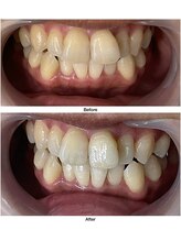 コアルナ センター北店(Coalna)/歯科提携・セルフホワイトニング
