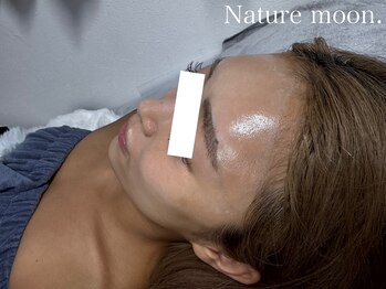 ナチュールムーン(Nature moon.)/ハーブピーリング after