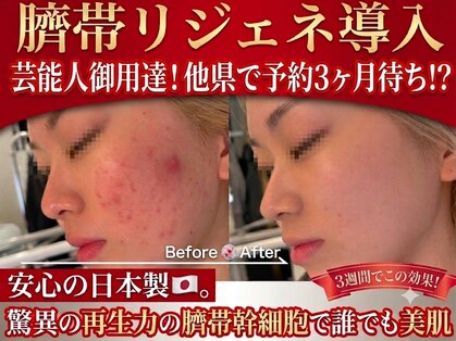 エステティック リオン(Rion)の写真