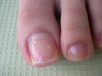 フットアドバンス 成城店/ネイルケア