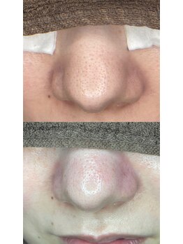 ネイル&アイラッシュ ルミア(Nail & Eyelash LUMIA)/Lumiaフォトギャラリー