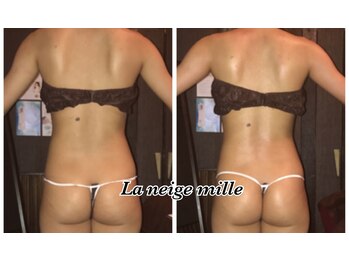 ラネージュミル(La neige mille)/インキュア