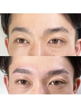 ビオプラス(BIO PLUS)/