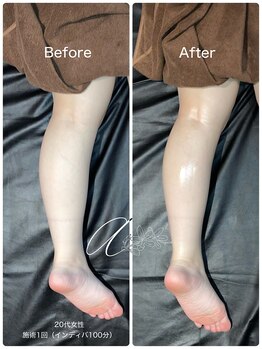 アランシア(Arancia)/