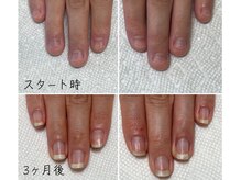 サロン ヒロコ(salon.hiroko*)の雰囲気（ネイルケアで、爪のピンク色の部分を育てて美爪にするケア）