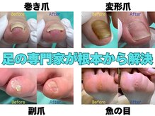 巻き爪補正店 徳重店