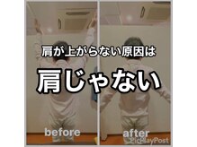 カワル整体 上通り院/肩の原因は肩にはありません。