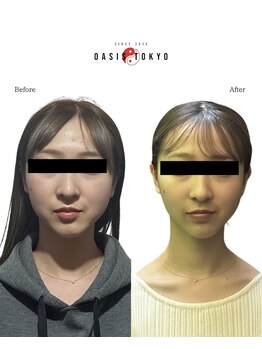 ネオオアシストウキョウ(ネオ OASIS TOKYO)/