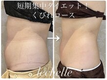 レシェルサロン(Lechelle Salon)/ハイパーナイフBODY