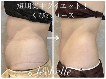 レシェルサロン(Lechelle Salon)/ハイパーナイフBODY