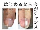 自爪育成/美爪育成/福岡東区香椎