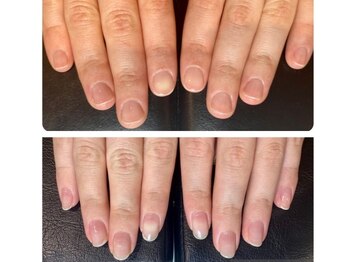 アンドネイル 海老名(&nail)の写真/【爪の形は変わります】丸爪/平爪/男爪などのお悩みの方◎♪ピンクの部分を伸ばし縦長の爪に成長させます。