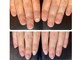 アンドネイル 海老名(&nail)の写真/【爪の形は変わります】丸爪/平爪/男爪などのお悩みの方◎♪ピンクの部分を伸ばし縦長の爪に成長させます。