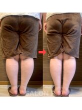 サロンアール(SALON R)/姿勢が変わりヒップアップ