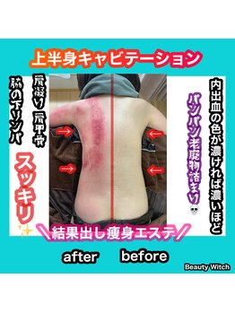 ビューティ ウィッチ(Beauty Witch)/