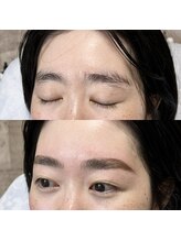 アイリー(IRIE)/ハリウッドブロウリフト