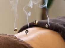 しのとう鍼灸整体院/灸頭鍼（きゅうとうしん）