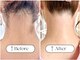 シャンティ(Shanti)の写真
