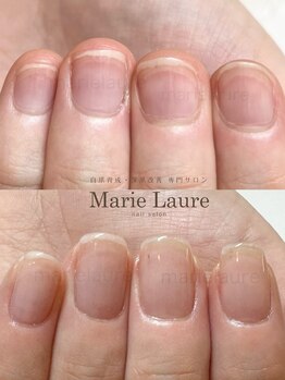 マリーロール 梅田店(Marie Laure)/深爪矯正/自爪育成/自爪風