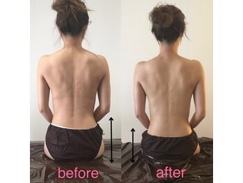 リセット(Reset.)/深層筋リンパ/ before → after