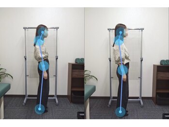 整骨院こころ 祇園院/ビフォーアフター