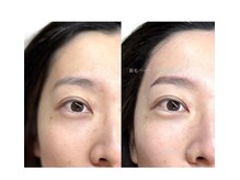 トリートマイセルフ(Treat myself)/waxでお肌のくすみにさよなら！