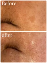 トータルビューティー ミミ(Total Beauty mimi)/