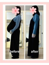 リスリム(Re:slim)/双子ちゃん妊婦さんの産後