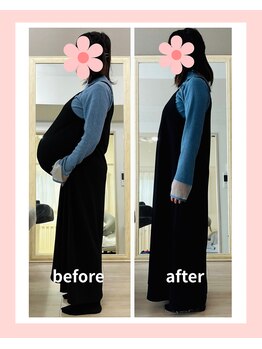 リスリム(Re:slim)/双子ちゃん妊婦さんの産後