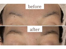 ヒビキ(Hibiki)/HBL before→after