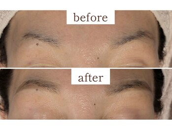 ヒビキ(Hibiki)/HBL before→after