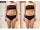 リュミエール(Lumiere)の写真/腰肉・下腹・寸胴ラインを集中ケア。服を美しく着こなせる立体的なくびれへ最速最短エステ