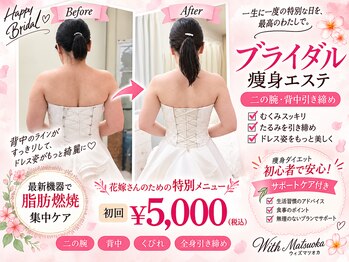 ウィズマツオカ 光の森店の写真/背中や二の腕を整え結婚式当日へ。本格痩身をまずは体験で理想を目指そう◎【初回 5000円】