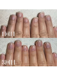 自爪育成/深爪育成/ジェルネイル