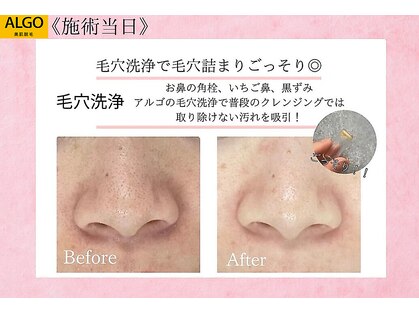 アルゴ 高槻店(ALGO)の写真