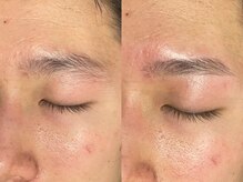 アオアイラッシュ 渋谷 表参道(ao.eyelash)/顔・骨格に合わせたデザイン