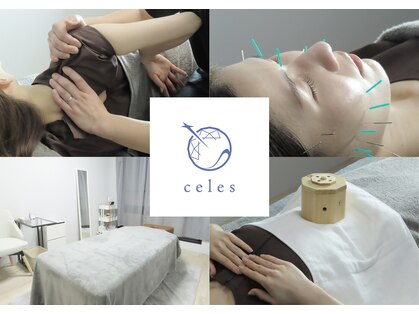 セレス(celes)の写真