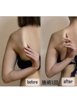 首・肩のつらさを改善したい