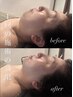 【至高の美】プレミアムコース｜輪郭・肌質・エイジングケアを網羅する90分