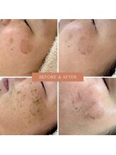 セレニティ バイ マリ(Serenity by Mari)/シーナジーピール