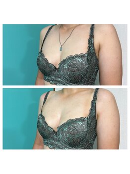 ネイト ワックス(Neit Wax)/肩こりの原因は首こり！