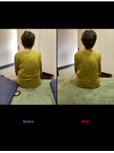 ストライクボディケア(STRIKE. BODY CARE)/姿勢の歪みによる腰痛（80代）