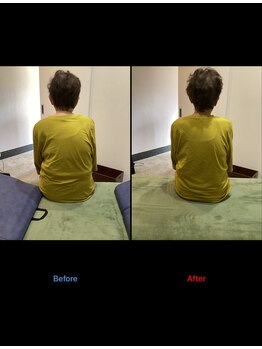 ストライクボディケア(STRIKE. BODY CARE)/姿勢の歪みによる腰痛（80代）