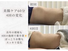 エイル(Eir.)/【腸もみ】before/after