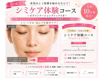 マリアンジュ(MariAnju)の写真/シミを隠す毎日から卒業！20分集中シミケア